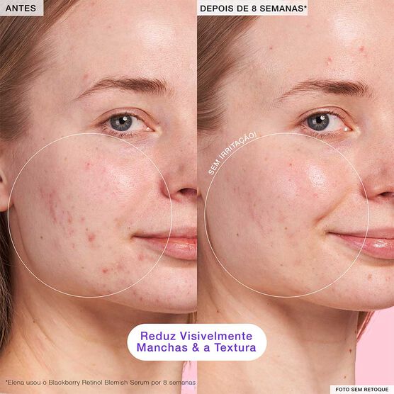 BLACKBERRY BLACKBERRY RETINOL SERUM 30ML
