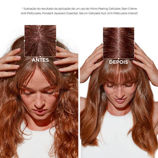 SYMBIOSE Micropeel