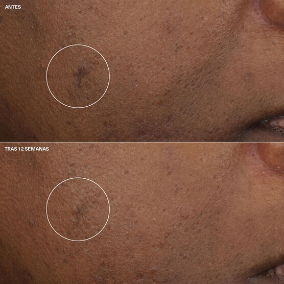 Even Better Clinical Bright Moisturizer