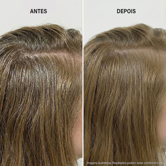 DERMA REGULATE DERMA REGULATE SHAMPOO