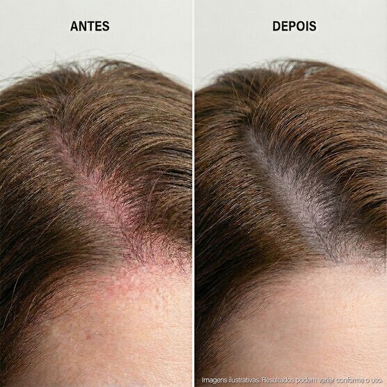 S&eacute;rum para Couro Cabeludo Sens&iacute;vel Keune Care Scalp Sensitive